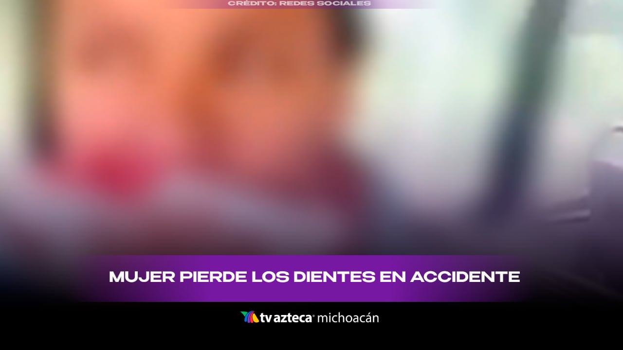 Mujer pierde los dientes tras accidente provocado por chofer de transporte público