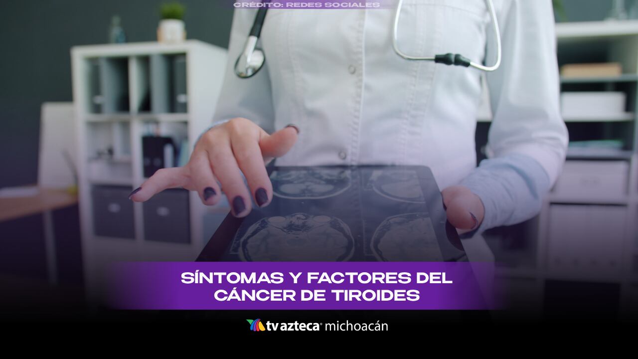 Cáncer de tiroides: conoce los síntomas y factores de riesgo