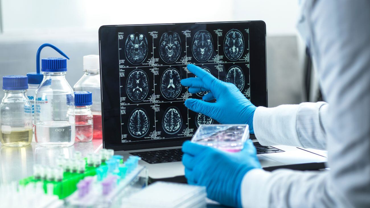 ¿Sabías que existen personas con Alzheimer que parecen completamente sanas? Conoce por qué pasa esto